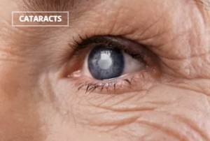Life-Changing Benefits of Corrective Eye Surgery